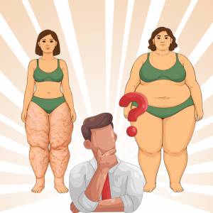 lipedema x obesidade